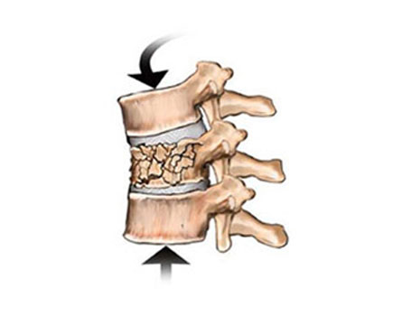 Best Spine Surgeon in Dubai