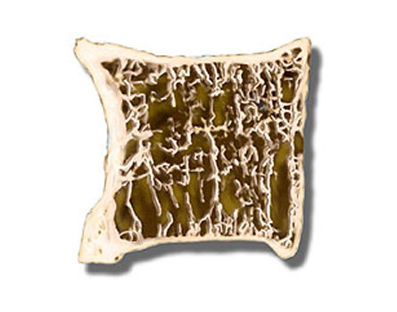 Best Spine Surgeon in Dubai