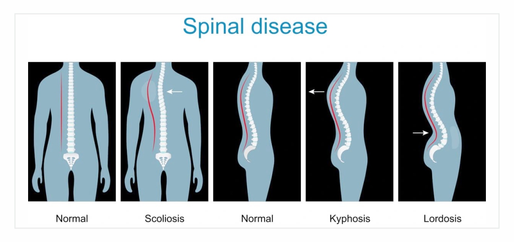 Best Spine Surgeon in dubai, UAE - Dr. Mehendi Hassan Ansari 