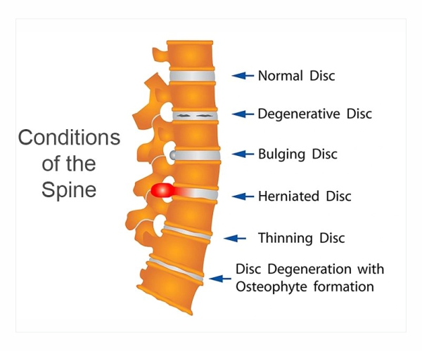 Best Spine Surgeon in dubai, UAE - Dr. Mehendi Hassan Ansari 