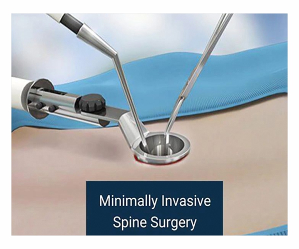 Best Spine Surgeon in dubai, UAE - Dr. Mehendi Hassan Ansari 