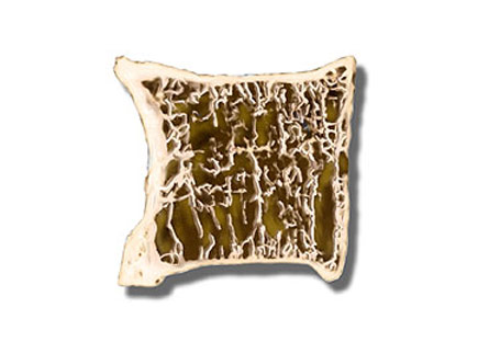  Dr. Ansari - Best Spine Surgen in Dubai 