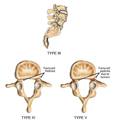  Best Spine Surgeon in Dubai