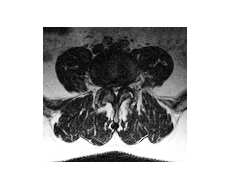  Best Spine Surgeon in Dubai