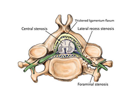  Best Spine Surgeon in Dubai