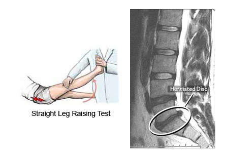  Dr. Ansari - Best Spine Surgen in Dubai 